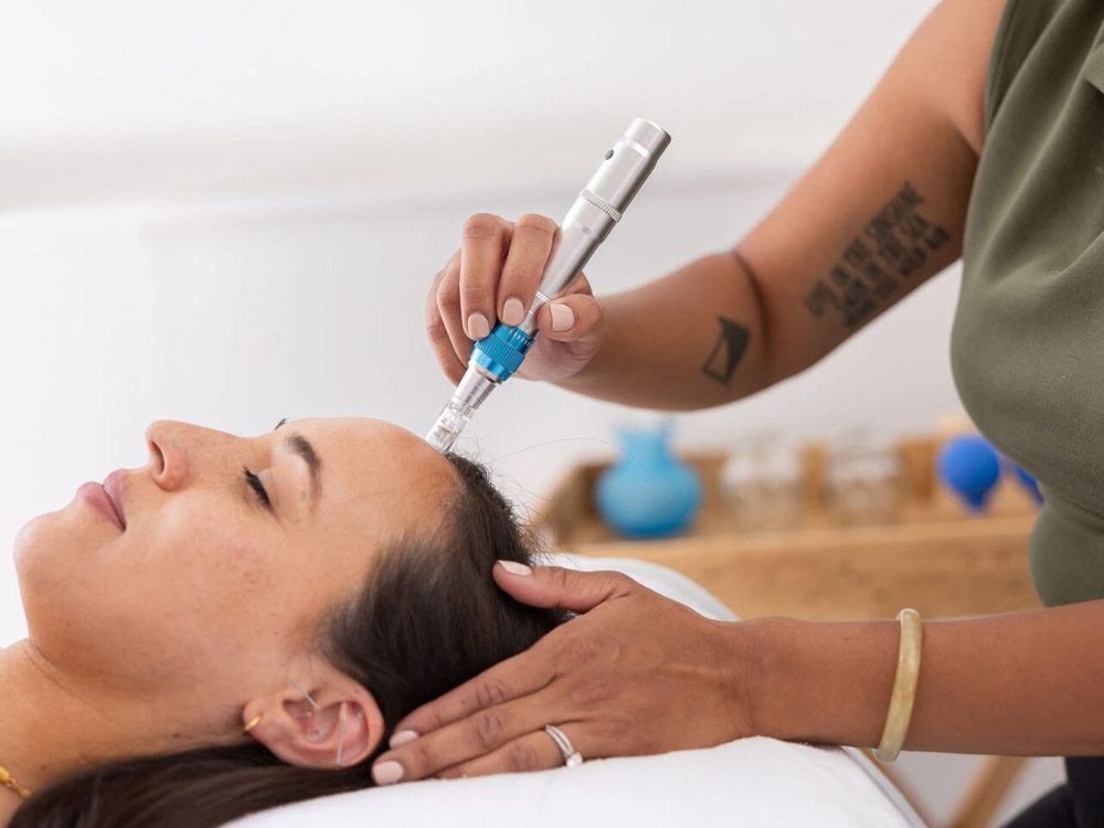 Dr. Monee performing a microneedling facial Dr. Monee performing a microneedling facial