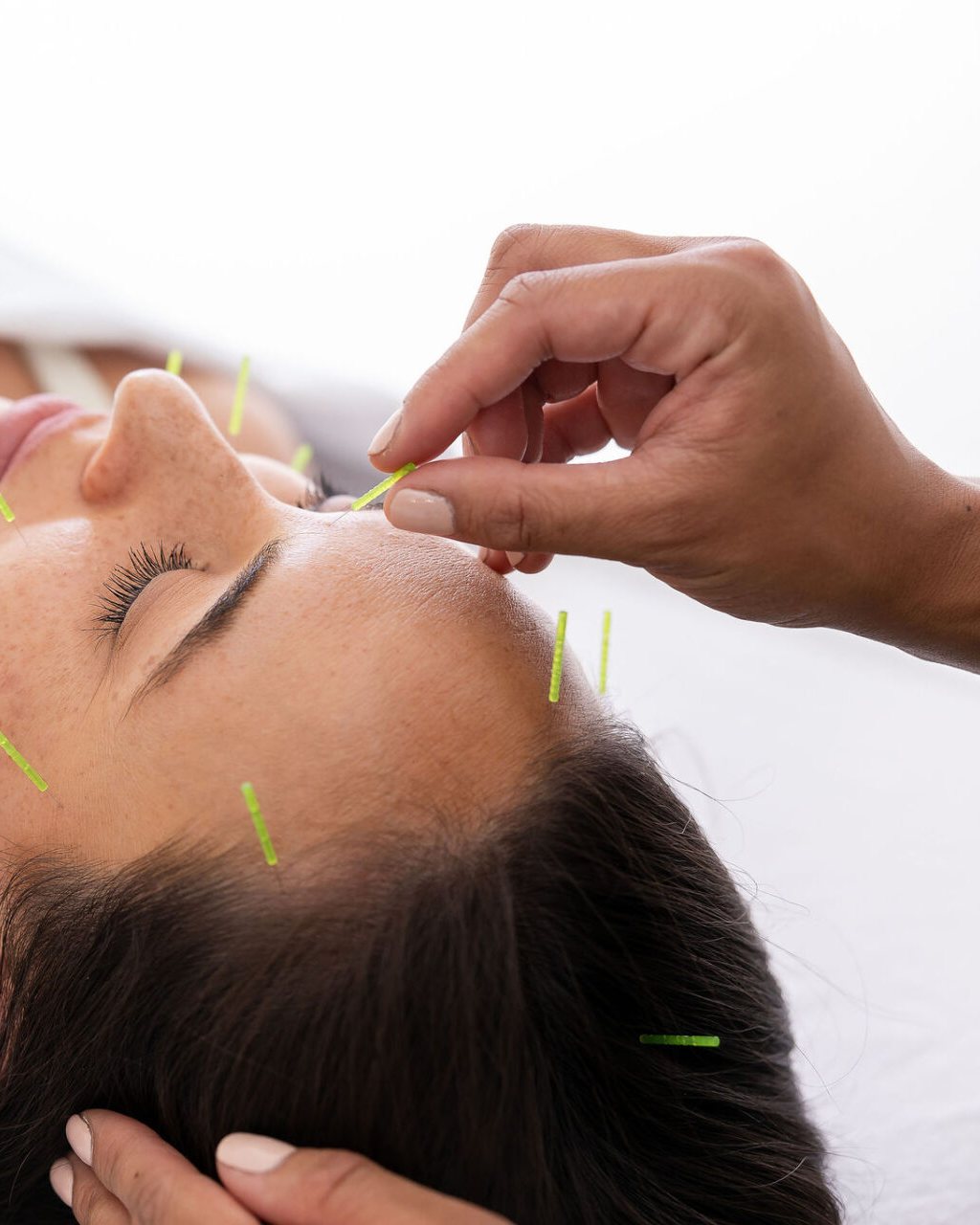 Dr. Monee placing fine cosmetic acupuncture needles on a client's face